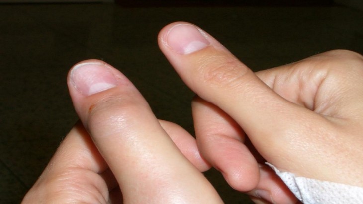 आपके अंगूठे का आकार बताएगा कैसा होगा आपका जीवन, यहां जाने अपना भविष्य