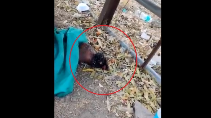 Video: बुजुर्ग महिला के पैर पर हजारों कीड़ों ने डाल रखा था डेरा और फिर