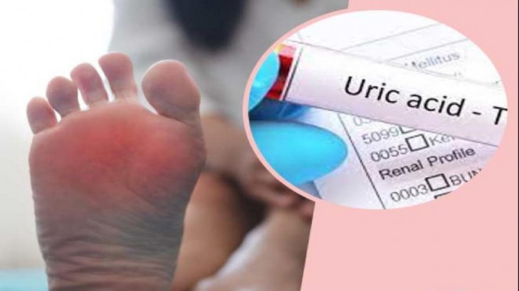 home remedies to reduce uric acid problem