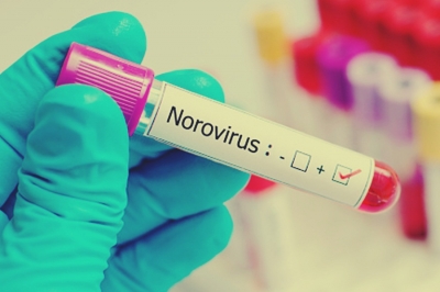 Noroviru outbreak