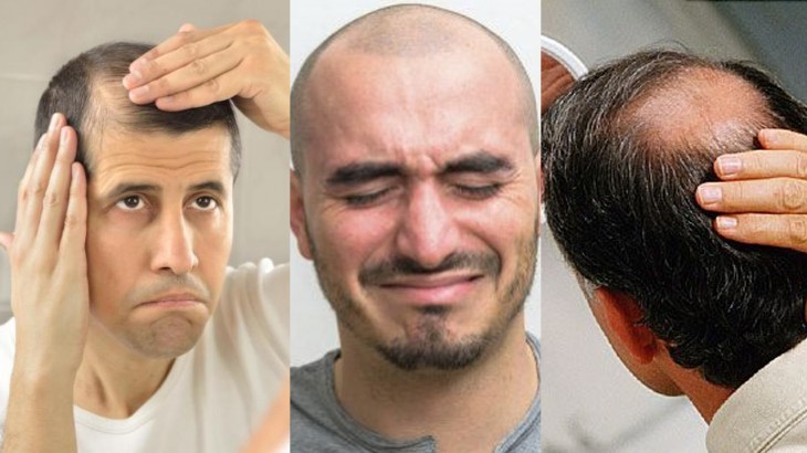 hairfall and hair growth treatment