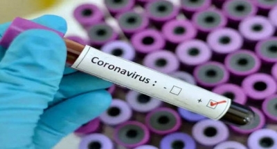 coronaviru