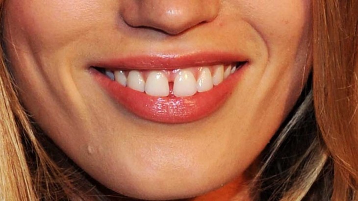 दांतों की खुली खिड़की खोल देती है मालामाल होने का रास्ता