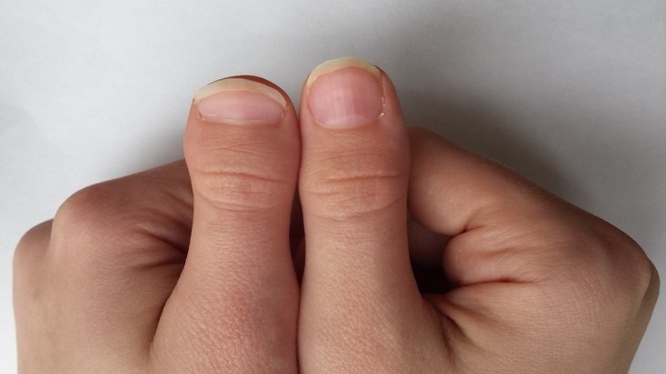 Thumb Palmistry