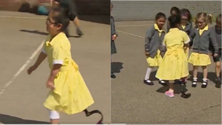 Physically Challenged Girl Viral Video