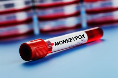 MonkeypoxIANS Infographic