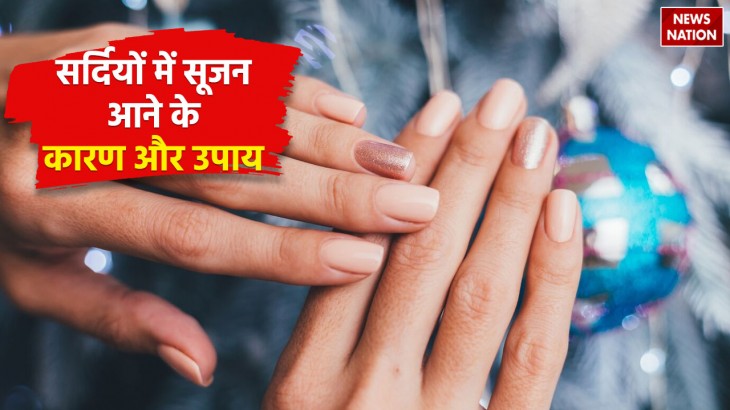 fingers swollen in winter see here reasons and home remedies