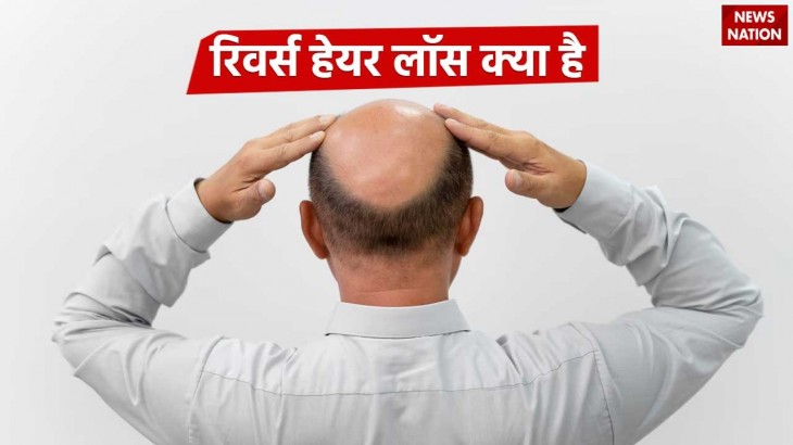 What is Reverse Hair Loss